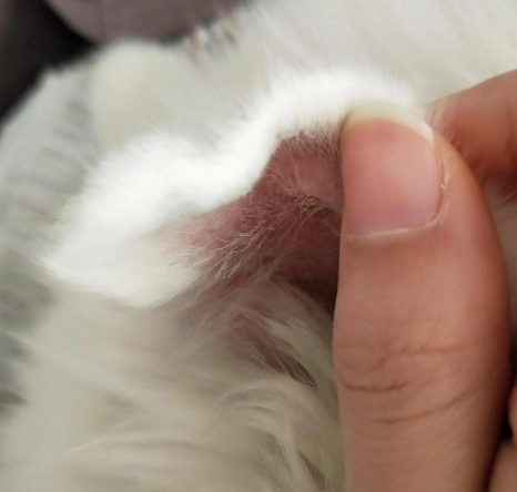 耳血腫手術費用