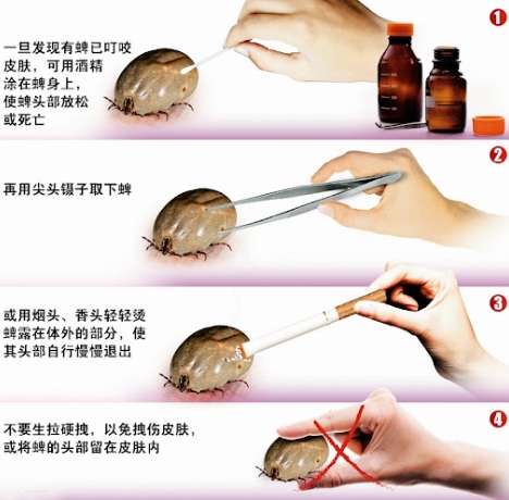 牛蜱處理方法全攻略：安全移除技巧與預防指南