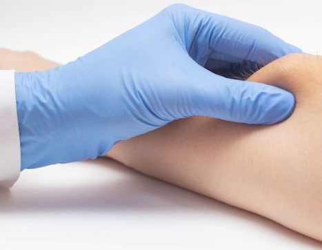 脂肪瘤自然消退 脂肪瘤自然消退