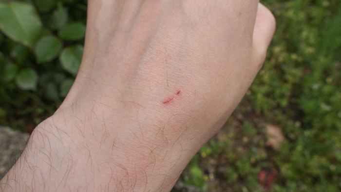 小傷口狂犬病 小傷口狂犬病