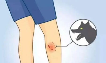 被狗咬處理方法