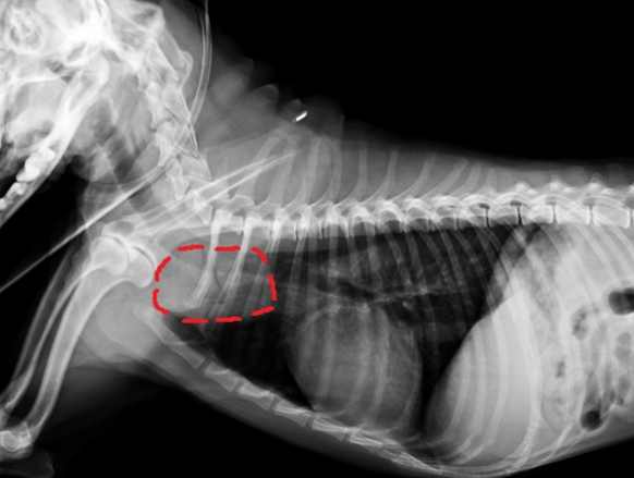 胸腔腫瘤症狀 胸腔腫瘤症狀