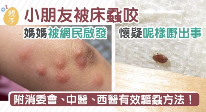 壁蝨叮咬處理