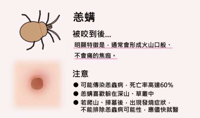 壁蝨叮咬處理