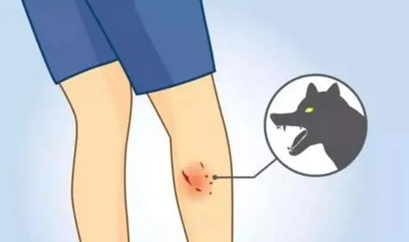 狗咬傷口清潔 狗咬傷口清潔