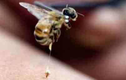 蜜蜂螫傷處理