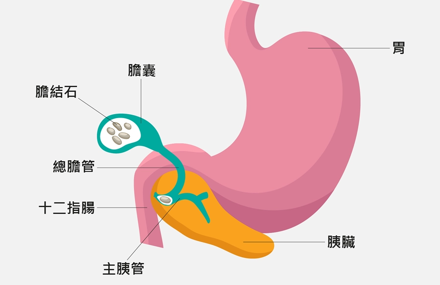 胰臟炎症狀 胰臟炎症狀