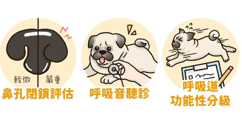 軟顎切除手術花費