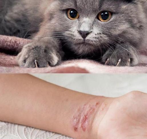 被貓抓傷藥膏 被貓抓傷藥膏