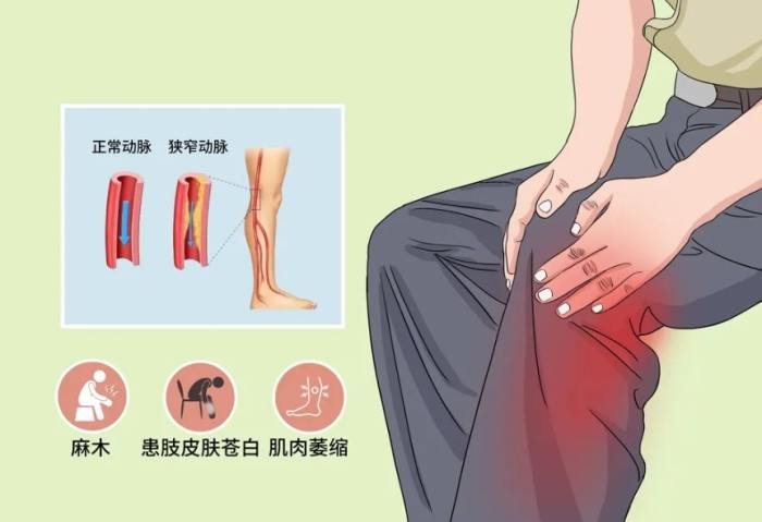 癲癇發作急救 癲癇發作急救