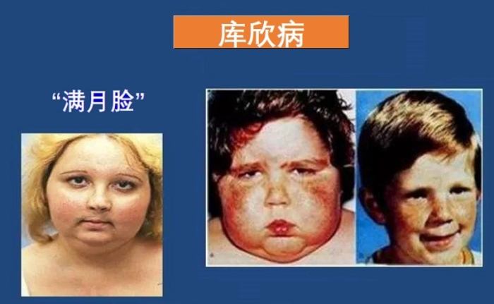 皮質醇檢測 皮質醇檢測