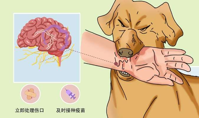 被狗咬打針 被狗咬打針