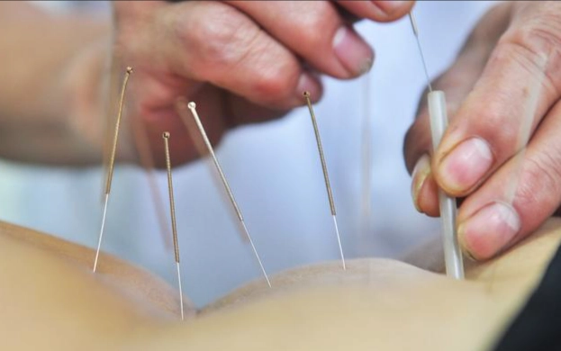 脂肪瘤針灸 脂肪瘤針灸