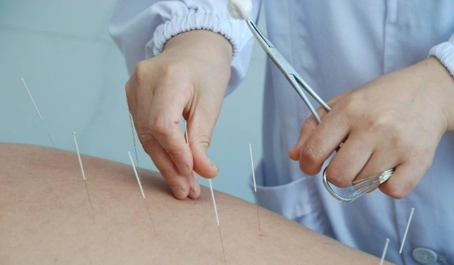 脂肪瘤中醫治療 脂肪瘤中醫治療