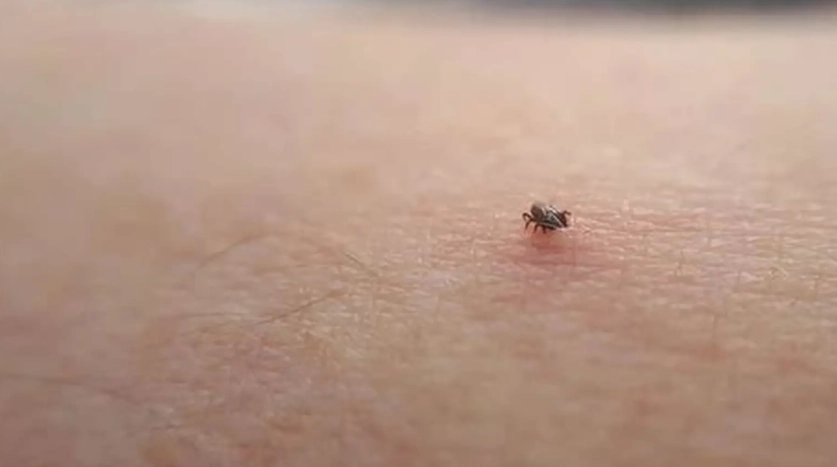 人被壁蝨咬症狀 人被壁蝨咬症狀